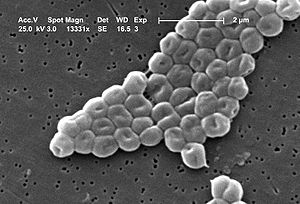 Acinetobacter