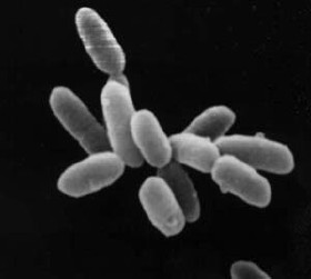 Archaebacteria