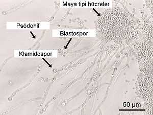 Candida albicans