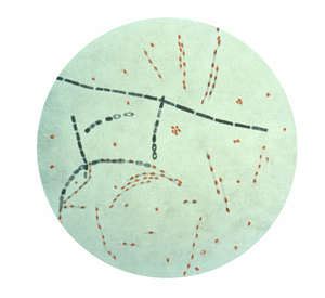 Bacillus anthracis