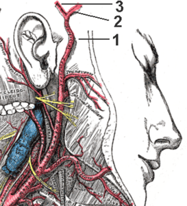 Dev hücreli arterit