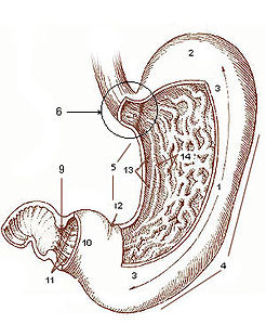 Gastrektomi