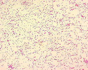 Gram-negatif