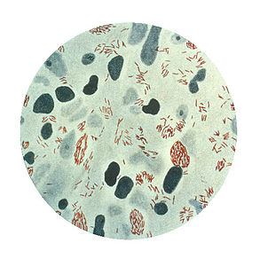 Mycobacterium Leprae