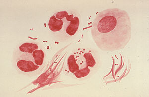 Neisseria gonorrhoeae