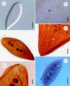 Opalinida