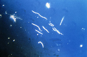 Borrelia burgdorferi