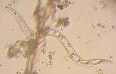 Nematoda