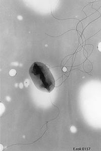 Escherichia coli O157:H7