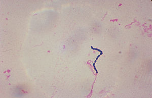 A grubu streptokoklar