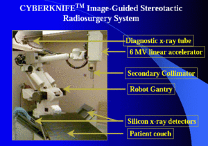 CyberKnife