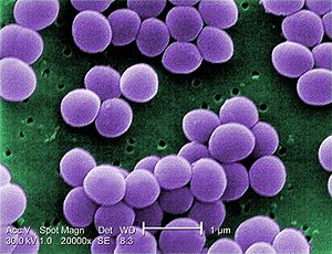 Staphyloccus aureus