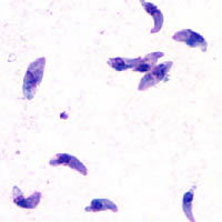 Toxoplasma