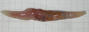 Trematoda