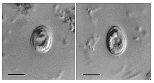 cryptosporidiosis