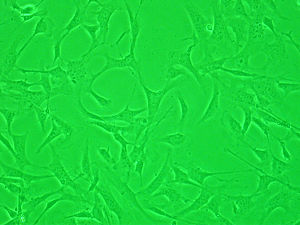 fibroblast