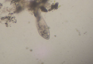 paramecium