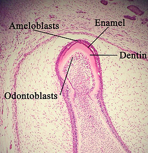 ameloblast