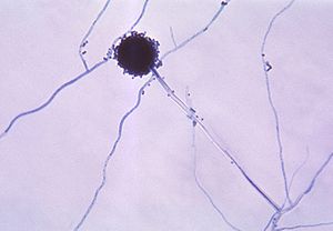 aspergillus